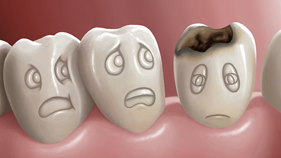 prevent tooth decay