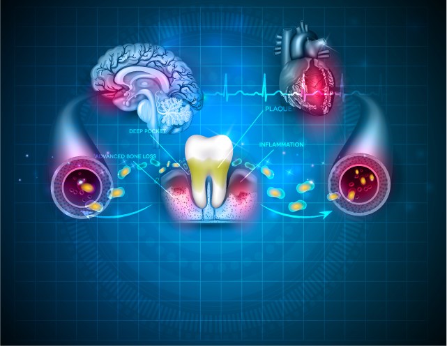 Periodontal Disease DentalHygiene Dentist in Sugarland TX A 09.23.19